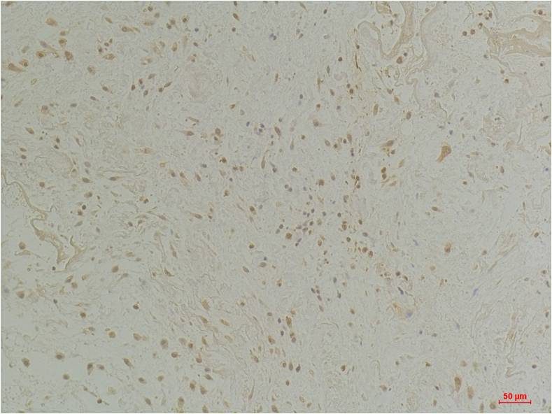 CLIC1 Polyclonal Antibody (A216)