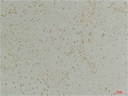 CLIC1 Polyclonal Antibody (A216)