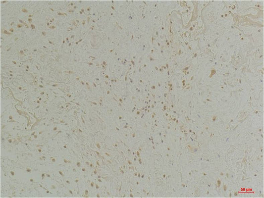 CLIC1 Polyclonal Antibody (A216)
