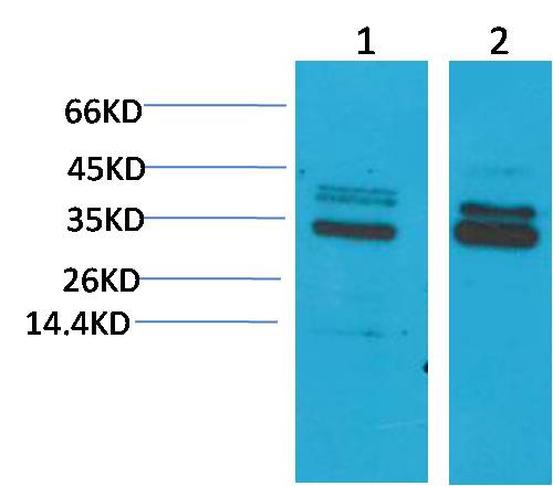 CLIC4 Polyclonal Antibody (A217)