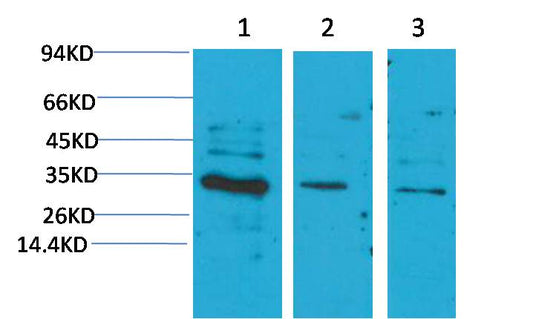 CNTF Polyclonal Antibody (A218)