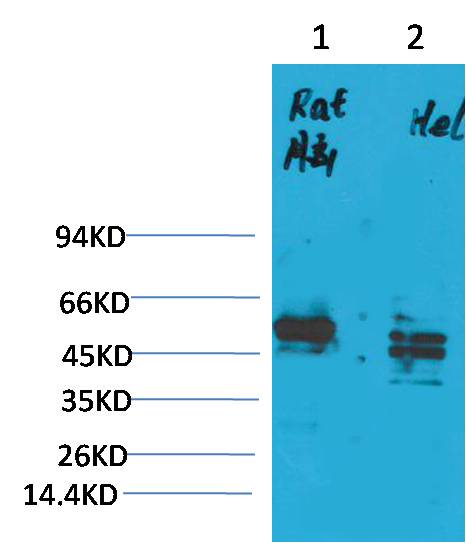 CXCR 4 Polyclonal Antibody (A220)