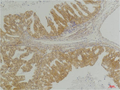 CXCR 4 Polyclonal Antibody (A220)