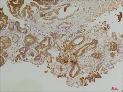 Endothelin B Receptor Polyclonal Antibody (A221)