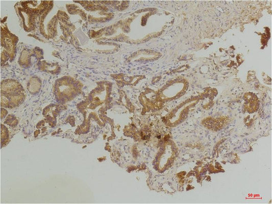 Endothelin B Receptor Polyclonal Antibody (A221)