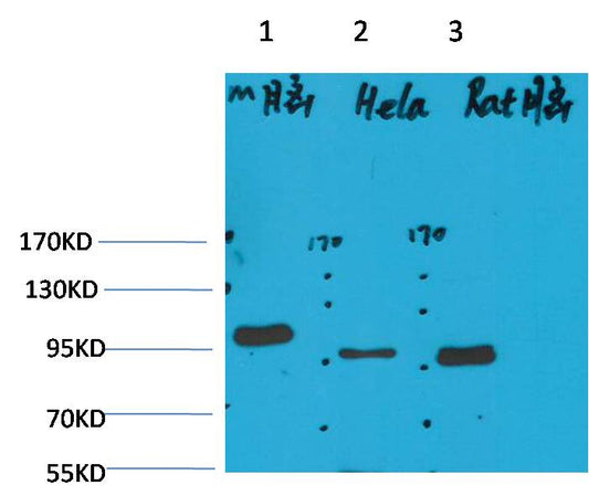 EphA1 Polyclonal Antibody (A222)