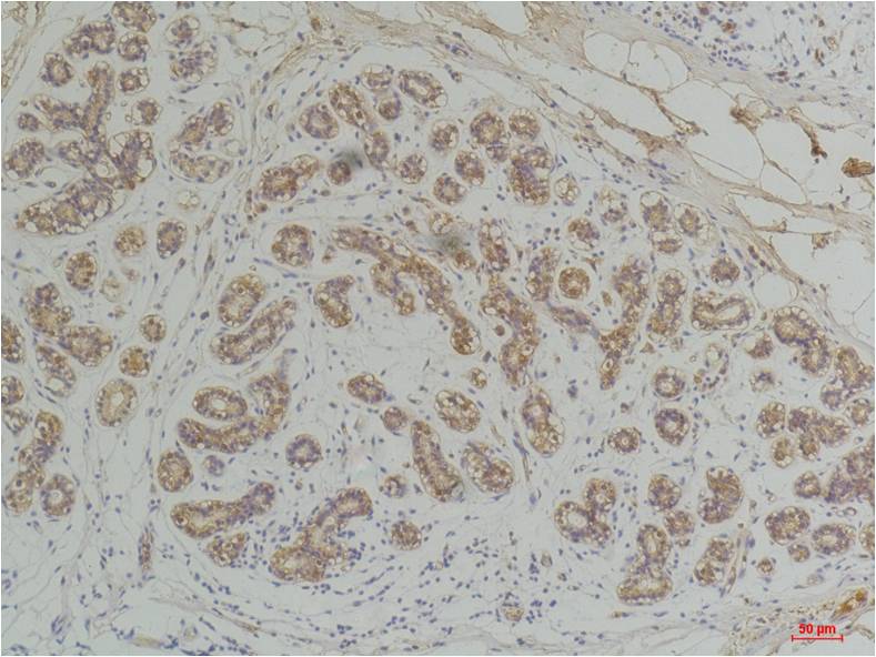 EphA1 Polyclonal Antibody (A222)