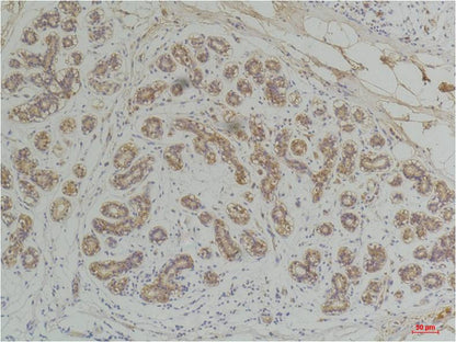 EphA1 Polyclonal Antibody (A222)