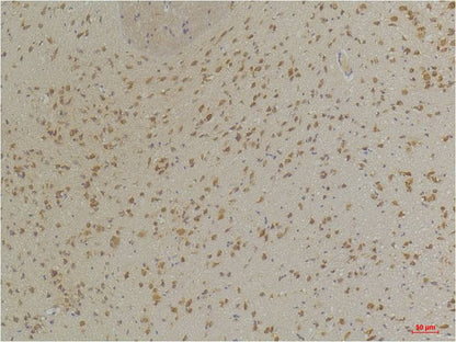 GABA A Receptor Alpha3 Polyclonal Antibody (A225)