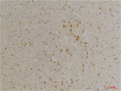 GABA A Receptor Alpha4 Polyclonal Antibody (A226)