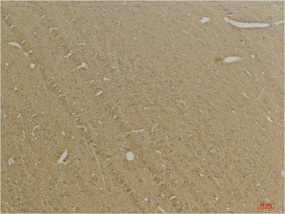 GABA B Receptor 2 Polyclonal Antibody (A228)