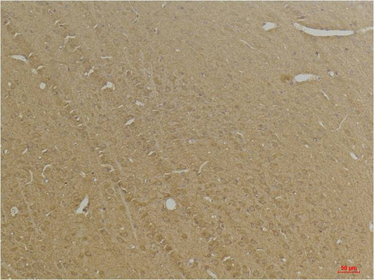 GABA B Receptor 2 Polyclonal Antibody (A228)
