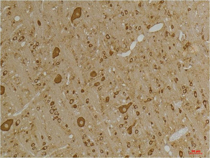 GABA A Receptor Gamma2 Polyclonal Antibody (A229)