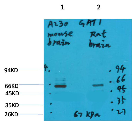 GABA Transporter 1 Polyclonal Antibody (A230)