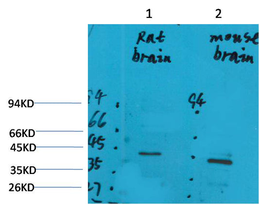 GALR2 Polyclonal Antibody (A231)