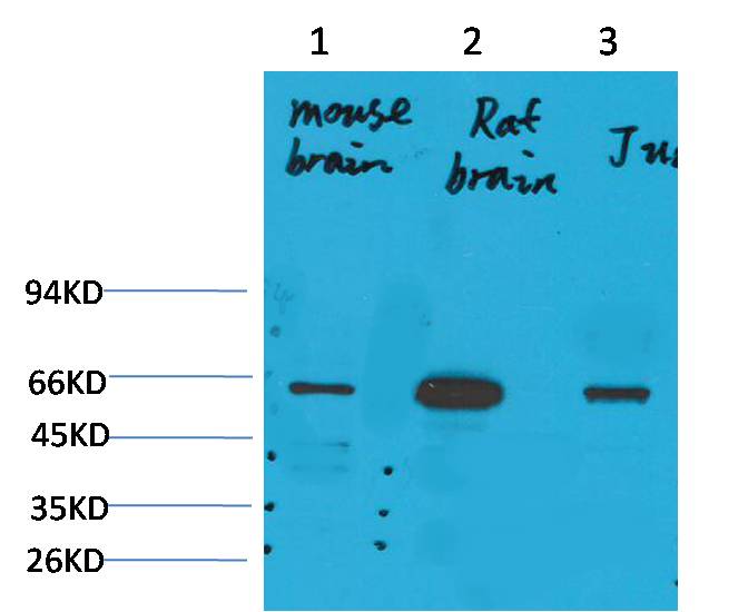 KCNK10 (TREK-2) Polyclonal Antibody (A237)