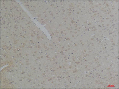 KCNK10 (TREK-2) Polyclonal Antibody (A237)