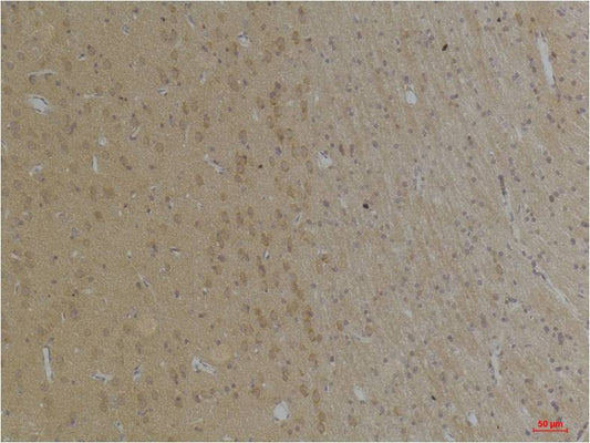 KCNK4 (TRAAK) Polyclonal Antibody (A238)