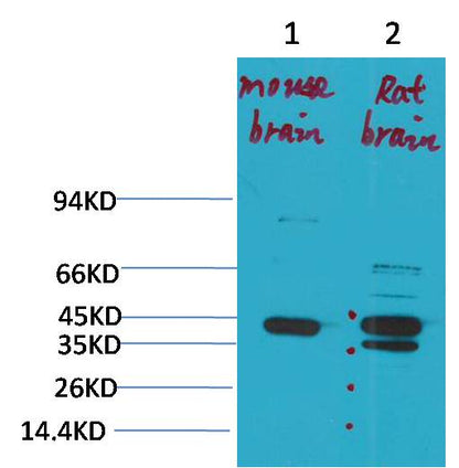 KCNK9 (TASK-3) Polyclonal Antibody (A239)