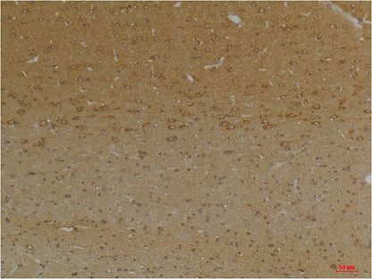 KCNK9 (TASK-3) Polyclonal Antibody (A239)