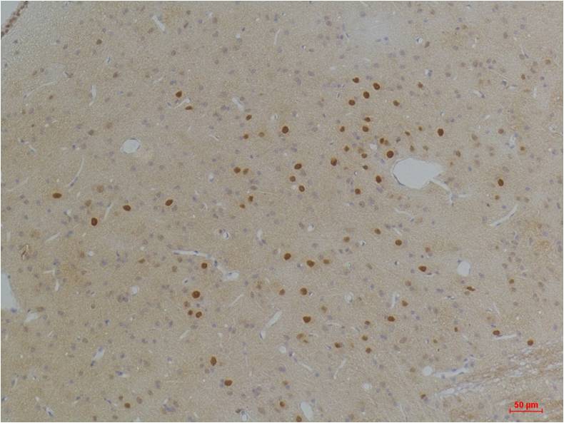 Kv1.1 potassium channel Polyclonal Antibody (A242)