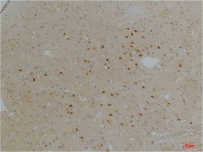 Kv1.1 potassium channel Polyclonal Antibody (A242)