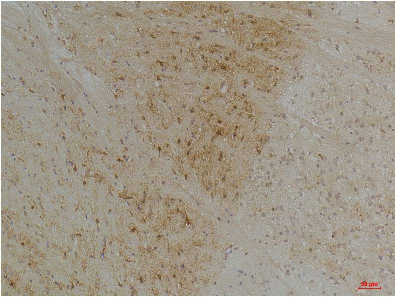 Kv1.1 potassium channel Polyclonal Antibody (A243)