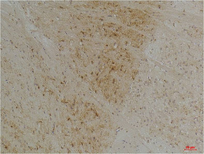 Kv1.1 potassium channel Polyclonal Antibody (A243)