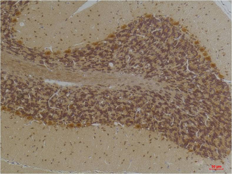 KCNN2 (SK2) Polyclonal Antibody (A244)