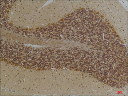 KCNN2 (SK2) Polyclonal Antibody (A244)