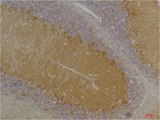 KCNN3 (SK3) Polyclonal Antibody (A246)