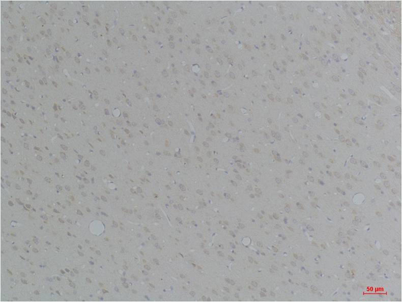 KCNN4 (SK4) Polyclonal Antibody (A247)