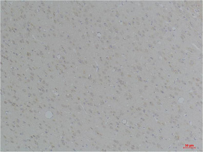 KCNN4 (SK4) Polyclonal Antibody (A247)