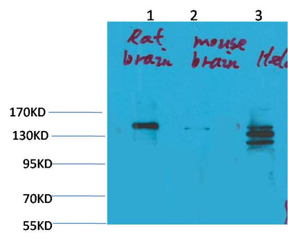 SLC12A4 Polyclonal Antibody (A248)