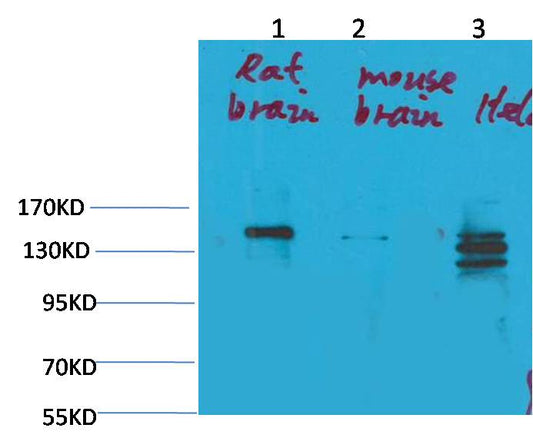 SLC12A4 Polyclonal Antibody (A248)