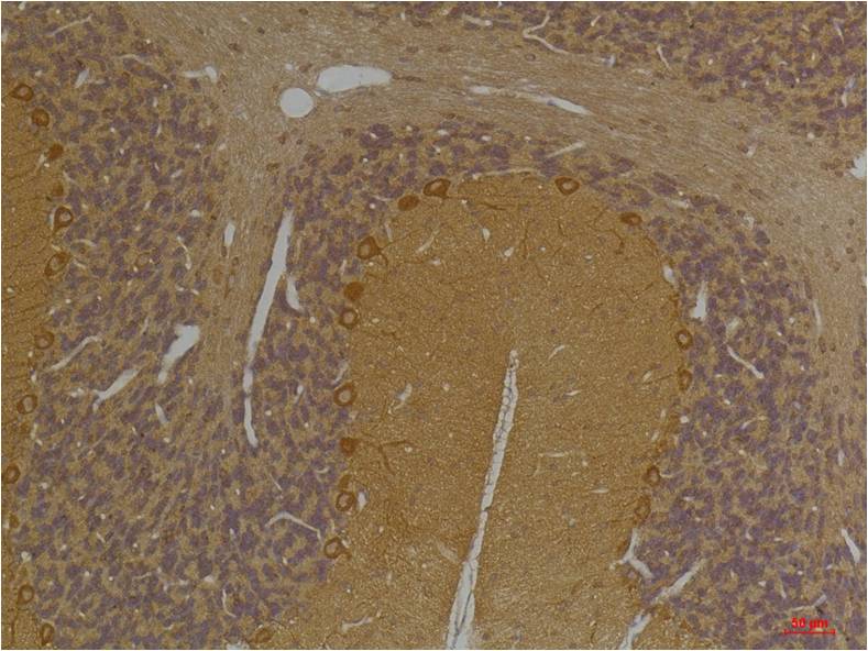 SLC12A4 Polyclonal Antibody (A248)