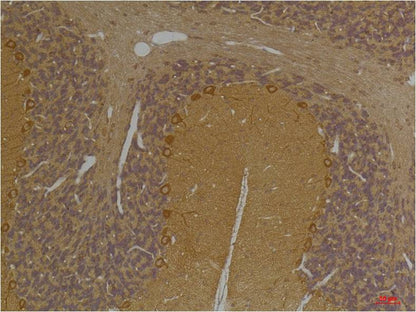 SLC12A4 Polyclonal Antibody (A248)