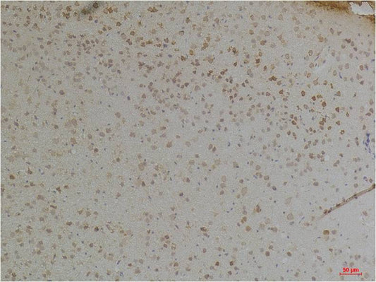 KChIP1 Polyclonal Antibody (A249)