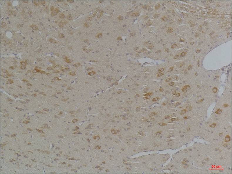 KChIP3 Polyclonal Antibody (A250)
