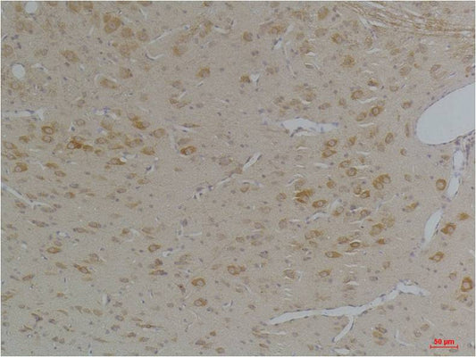 KChIP3 Polyclonal Antibody (A250)