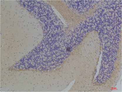KChIP3 Polyclonal Antibody (A250)