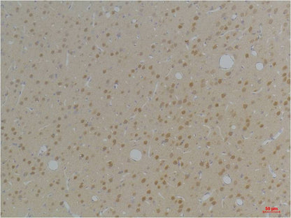 KVBeta1 Polyclonal Antibody (A255)