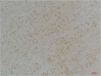 KVBeta1 Polyclonal Antibody (A255)