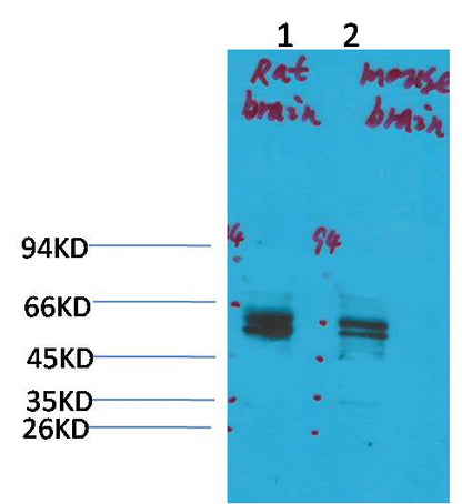 KV11.1 Polyclonal Antibody (A262)