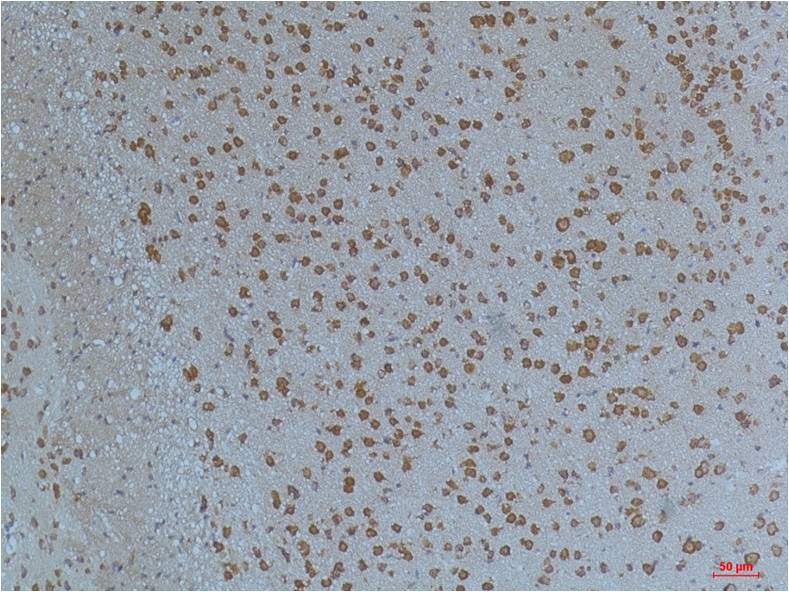 KV11.1 Polyclonal Antibody (A262)