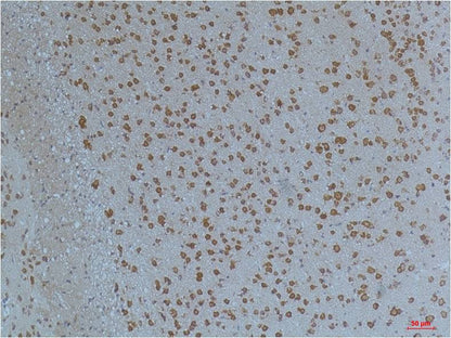 KV11.1 Polyclonal Antibody (A262)