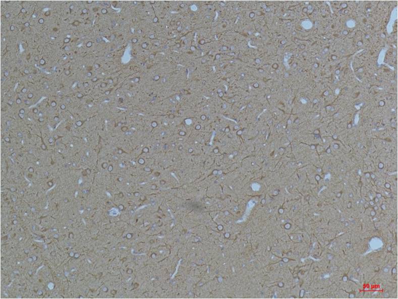KV11.3 Polyclonal Antibody (A263)