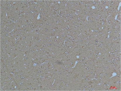 KV11.3 Polyclonal Antibody (A263)