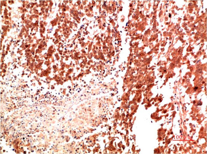 Met Polyclonal Antibody (c-met)