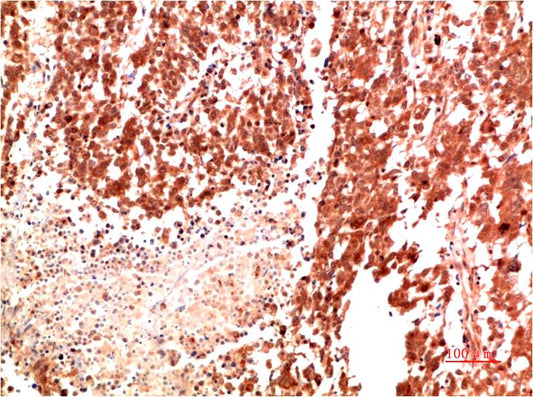 Met Polyclonal Antibody (c-met)